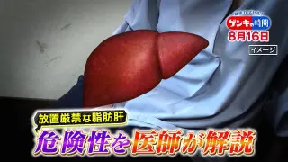 「脂肪肝」改善できる！？…注目の“改善入院”で学ぶ！脂肪肝の原因や改善法