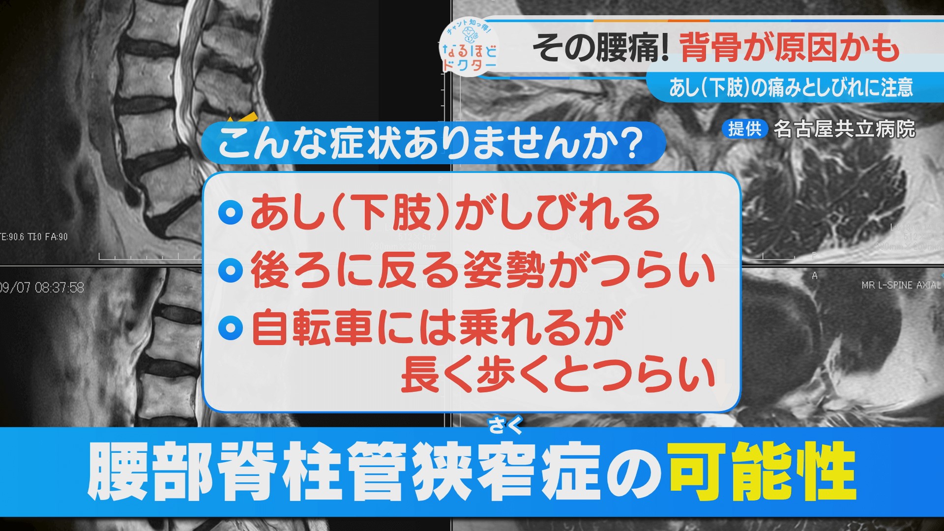 その腰痛“せぼねの病気”が原因かも【チャント！】