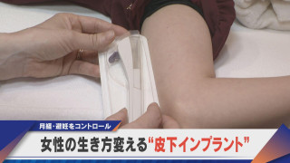 女性の生き方を変える 月経・避妊を管理 腕に“インプラント”【newsX】