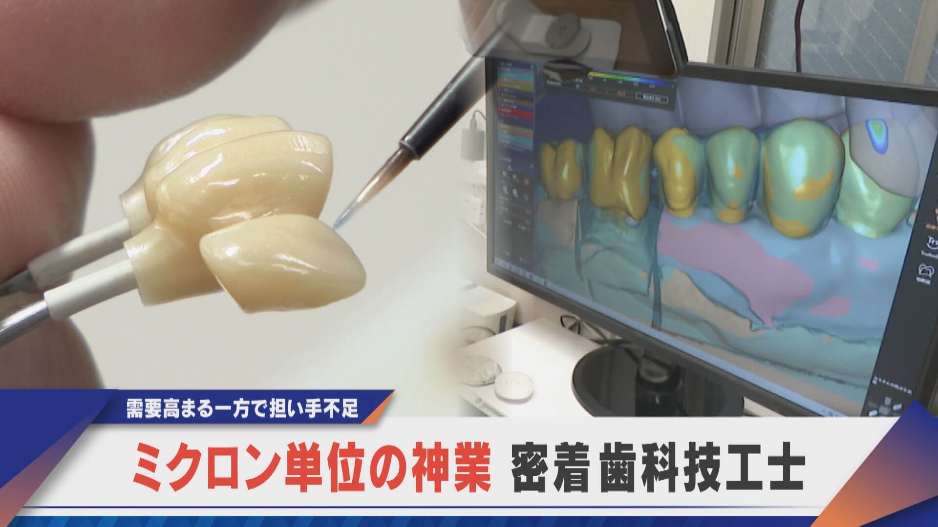 需要増え続ける義歯・インプラント 超絶の技“歯科技工士”の世界【newsX】