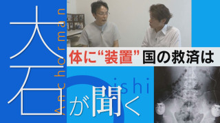 【大石が聞く】止まらない痛み…体内に装置、国の救済は