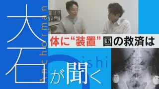 【大石が聞く】止まらない痛み…体内に装置、国の救済は