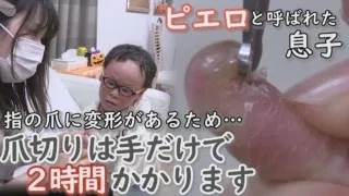 「痛い！」伸びた爪が皮膚に食い込む！？辛くても‥長時間ガマンの爪切り編…CBCテレビ 定期配信型 CBCドキュメンタリー「ピエロと呼ばれた息子」第３１話