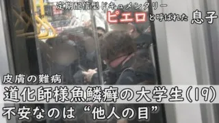 「私を見て笑う」「気持ち悪いと‥」“私の見た目”と“他人の目”‥１９歳の女子大生も悩む CBCテレビ定期配信型ドキュメンタリー「ピエロと呼ばれた息子」第３７話