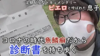 歩くだけで３９℃の発熱…落ちる皮膚に悩んだ修学旅行とは！？魚鱗癬の大学生に密着 　CBCテレビ定期配信型ドキュメンタリー「ピエロと呼ばれた息子」第３９話