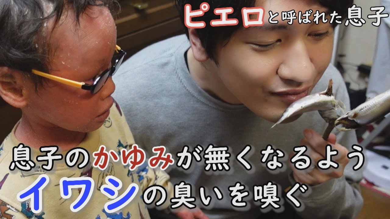 合言葉は“アラクサ”「かゆくならないように」と願って‥大みそかに豆まき！？道化師様魚鱗癬の男の子と家族の物語　CBCテレビ定期配信型ドキュメンタリー「ピエロと呼ばれた息子」第４０話