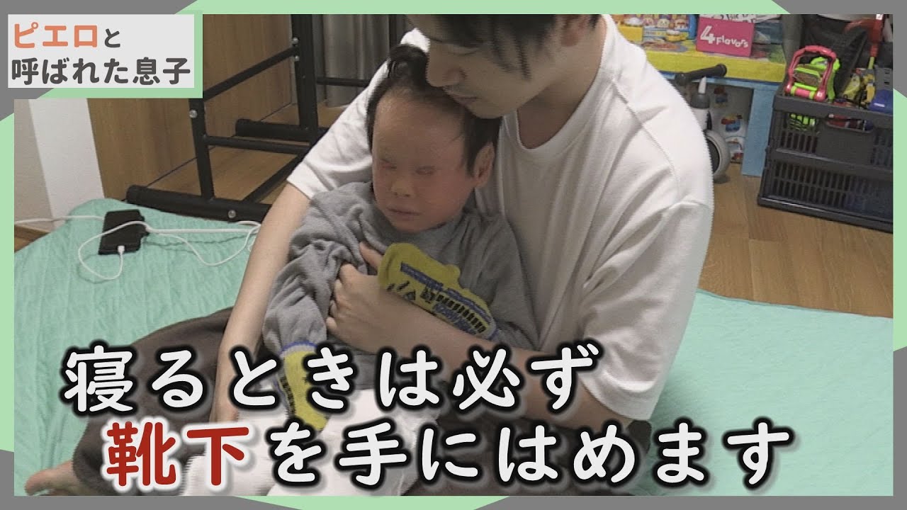 道化師様魚鱗癬は睡眠中が大変です！不眠不休‥母ちゃんのケアも…CBCテレビ定期配信型ドキュメンタリー「ピエロと呼ばれた息子」第４８話