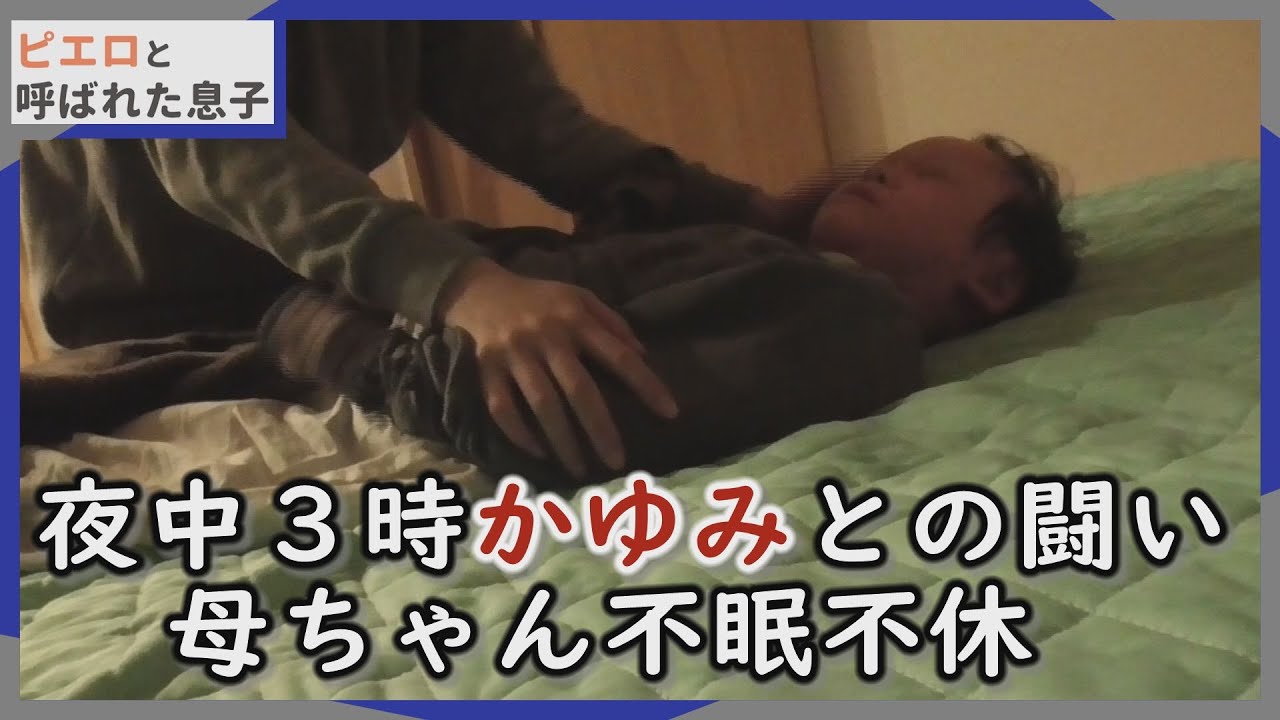 【深夜の撮影】睡眠中、全身のかゆみに襲われる賀久くん。出血も…CBCテレビ 定期配信型 ドキュメンタリー「ピエロと呼ばれた息子」第５０話