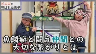 家族で京都へ！魚鱗癬の患者との交流はとても大切です…CBCテレビ定期配信型ドキュメンタリー「ピエロと呼ばれた息子」第５２話