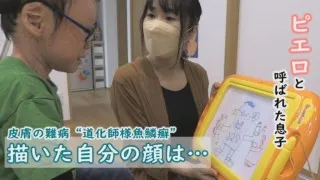自画像に変化が…５歳で自分の病気を理解し始める「ピエロと呼ばれた息子」第６６話