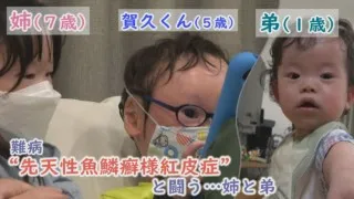 魚鱗癬と闘う仲間との交流…三重と京都の“魚鱗癬の会”「ピエロと呼ばれた息子」第67話