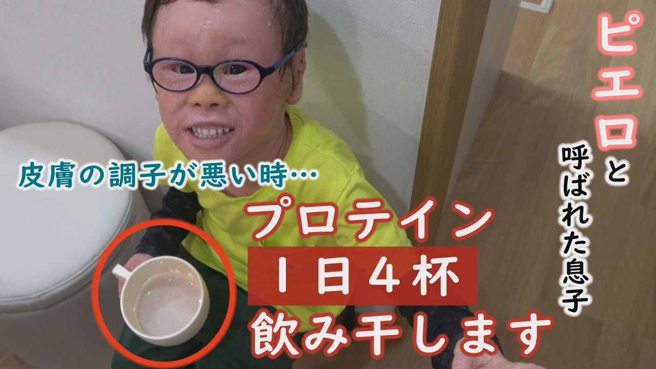 ５歳でも成人男性と同じくらい食べなくてはなりません。定期配信型ドキュメンタリー「ピエロと呼ばれた息子」第６９話