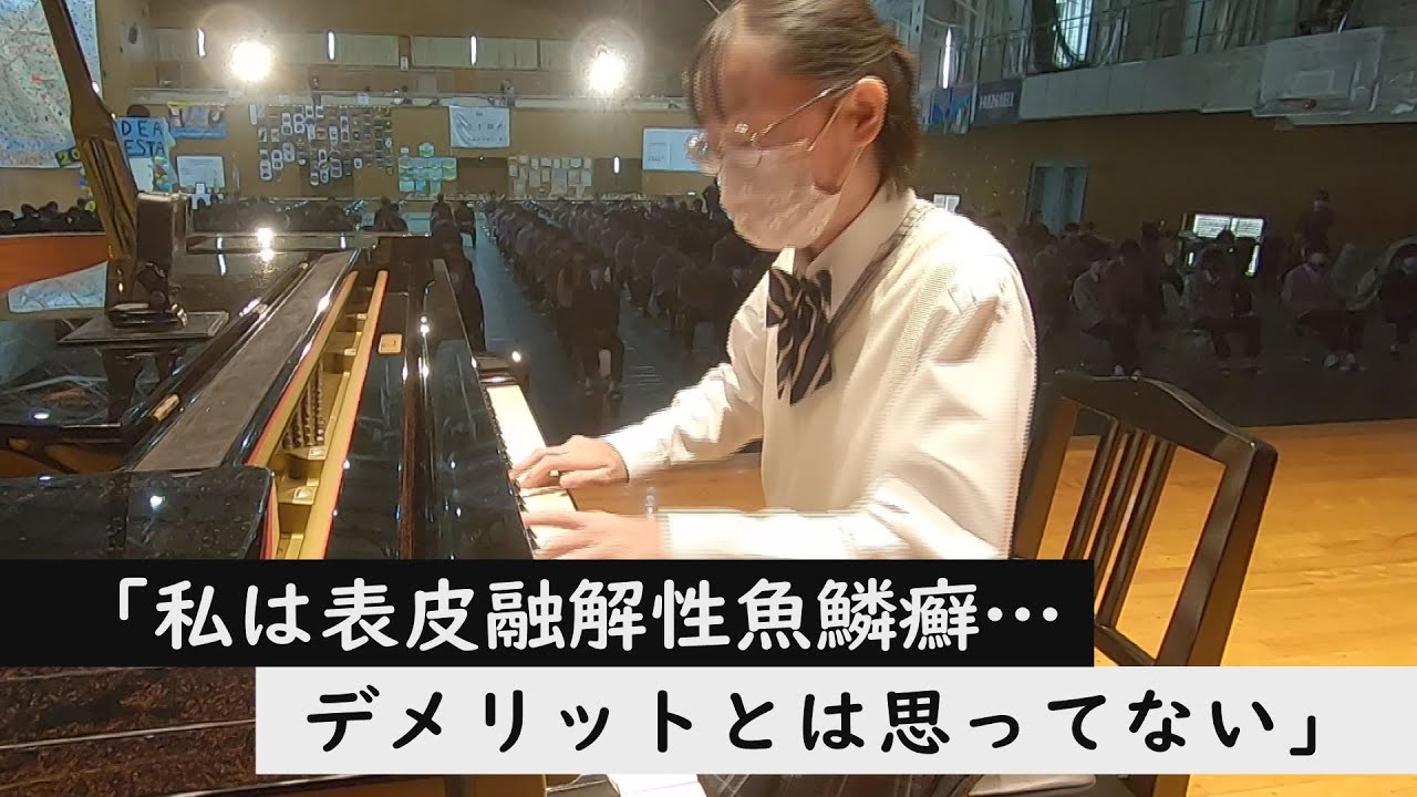 皮膚の難病と闘う高校生が“Official髭男dism”の曲を生演奏～定期配信型ドキュメンタリー「ピエロと呼ばれた息子」第76話