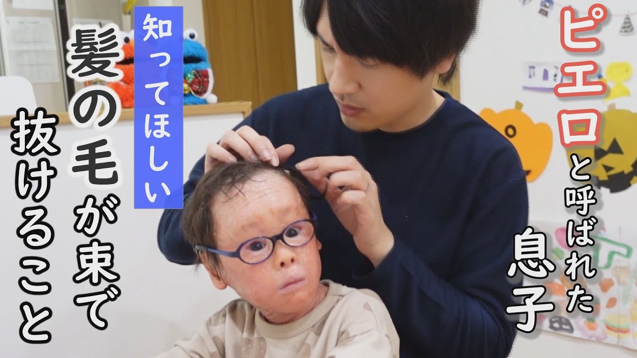 ハーレクイン魚鱗癬の兆候と症状