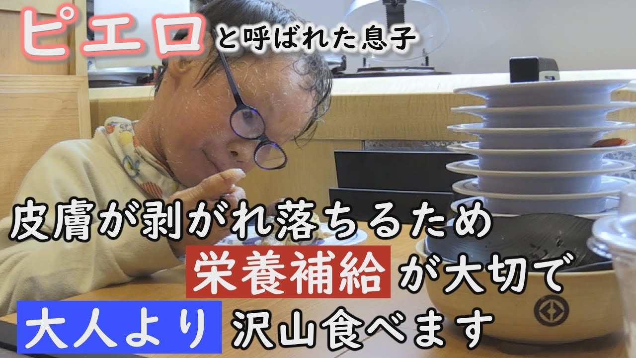 回転寿司で山積みの皿！いったい何皿食べたの？魚鱗癬は栄養補給が大切です…～定期配信型ドキュメンタリー「ピエロと呼ばれた息子」第90話