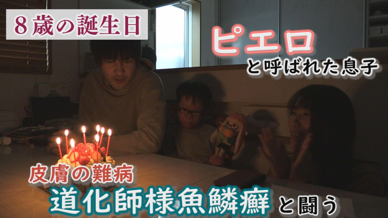 皮膚の難病と闘う～足の痛みと向き合う中、家族で迎えた誕生日～配信型ドキュメンタリー「ピエロと呼ばれた息子」第１３３話