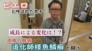 もうすぐ３年生！大きくなって剥がれる皮膚の量も…～配信型ドキュメンタリー「ピエロと呼ばれた息子」第１３４話