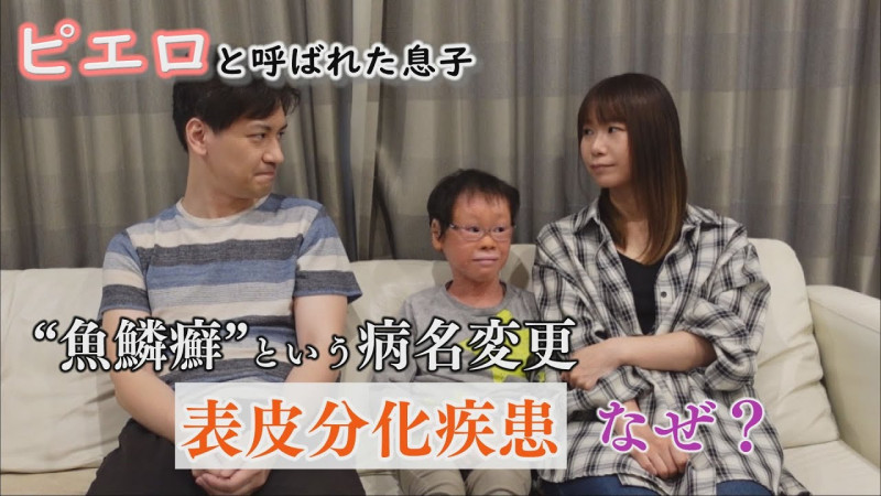 【最新話】魚鱗癬は“不快な病名だ”という指摘も…濱口家の受け止めは？　～配信型ドキュメンタリー「ピエロと呼ばれた息子」第１３５話
