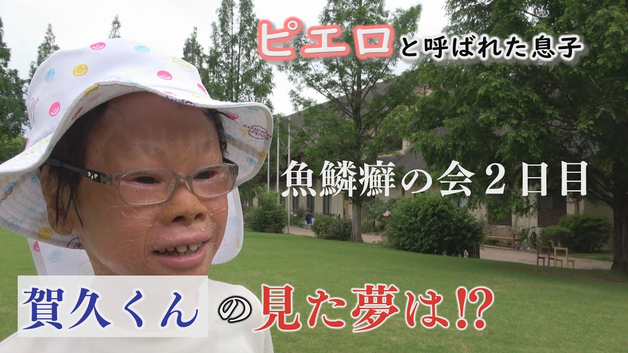 魚鱗癬の会でピアノ演奏…「がんばろう。がく」テーマソング～配信型ドキュメンタリー「ピエロと呼ばれた息子」第１３７話