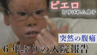 乾燥で皮膚にダメージも…ゲームに影響は？～配信型ドキュメンタリー「ピエロと呼ばれた息子」第１４１話