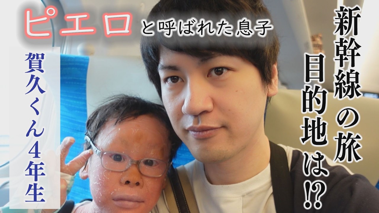 ２０２６年 皮膚の難病・道化師様魚鱗癬と闘う～配信型ドキュメンタリー「ピエロと呼ばれた息子」第１４２話